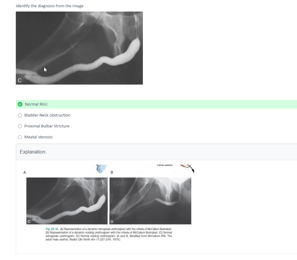 NEET-SS FNB MCh Urology Mcq Mock Exam Course - Image 2