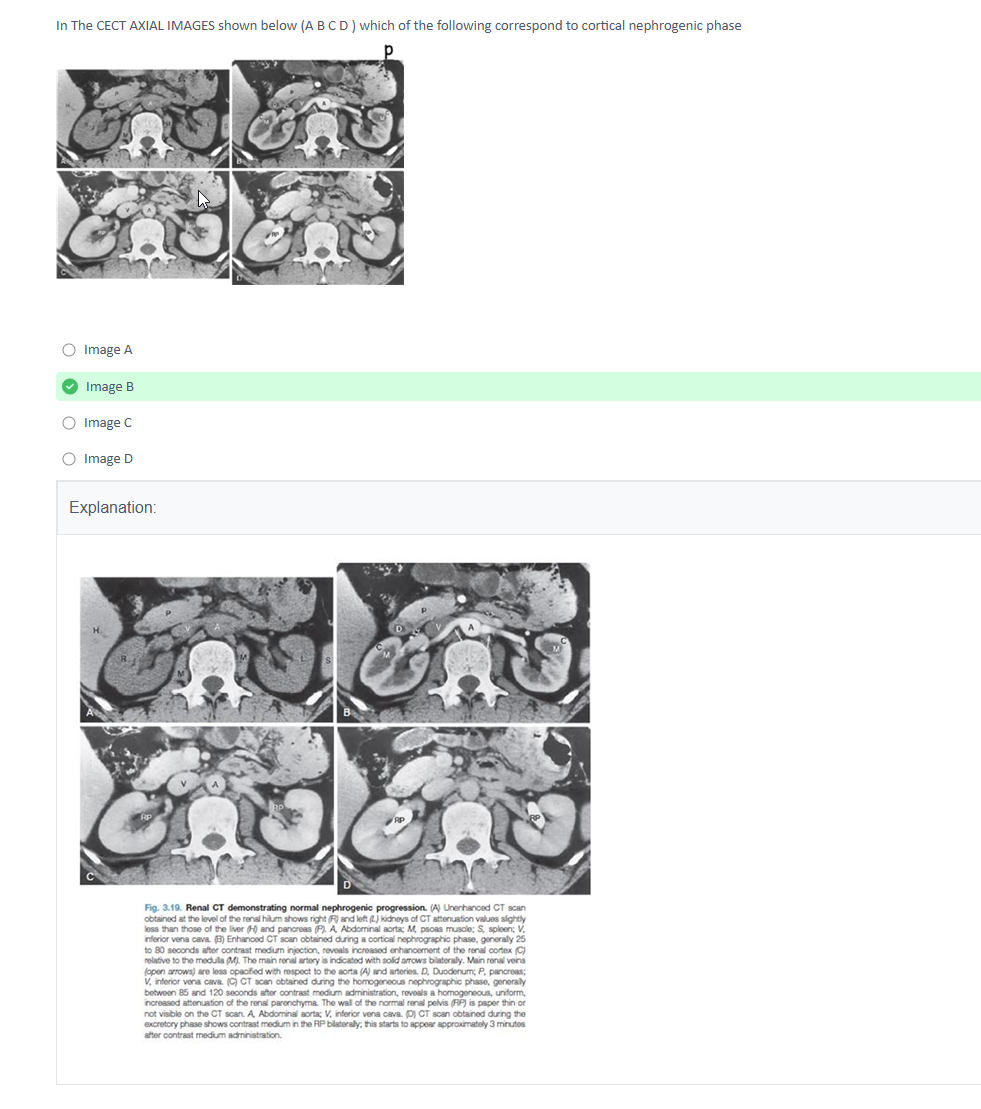 NEET-SS FNB MCh Urology Mcq Mock Exam Course - Image 3