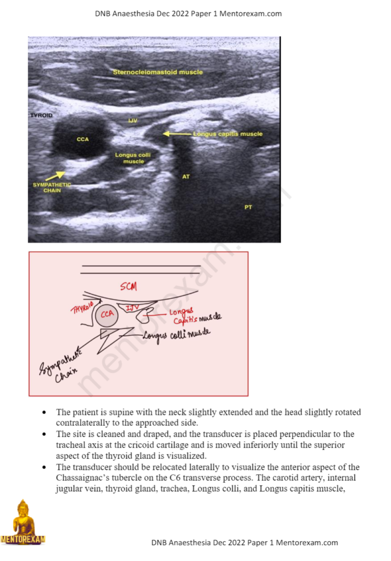 DNB MD Anaesthesia Solved Question Papers Grand Course 3