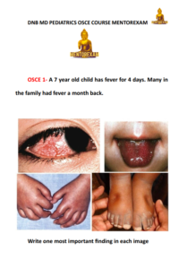 DNB MD Pediatrics OSCE Course 1