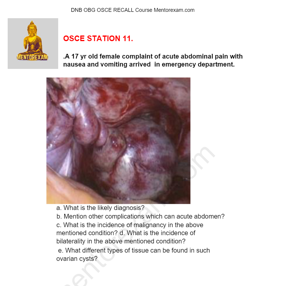 DNB MS Obstetrics Gynecology OSCE Course